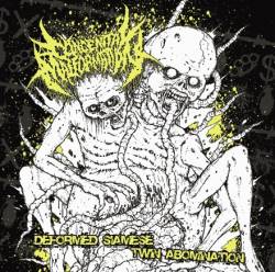 Congenital Malformation : Deformed Siamese Twin Abomination